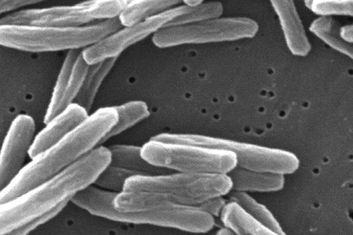 Bakterían sem veldur berklum séð í gegnum öreindasmásjá.
