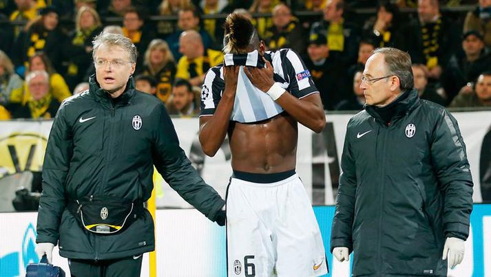 Pogba haltrar af velli gegn Dortmund.