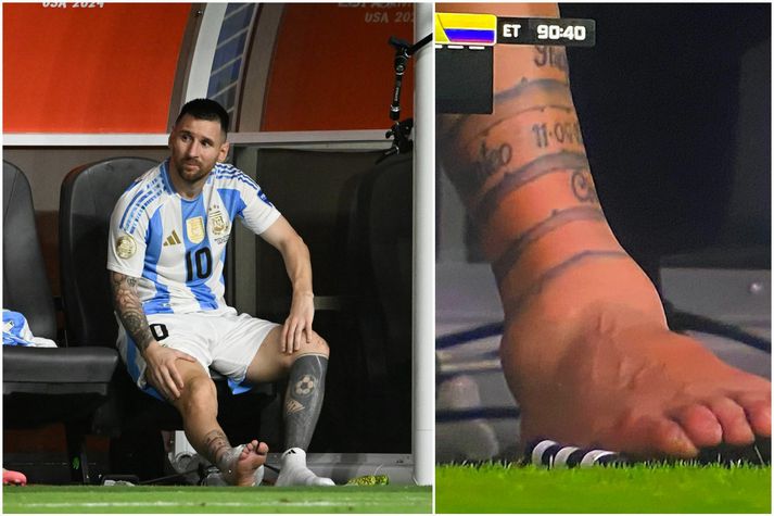Lionel Messi þurfti að fara meiddur af velli í úrslitaleik Copa America í nótt.