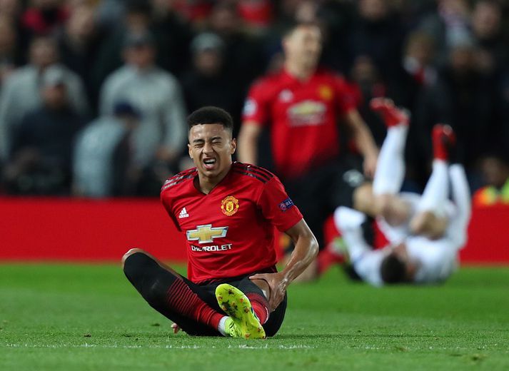 Jesse Lingard er einn af meiddu mönnunum hjá Manchester United.