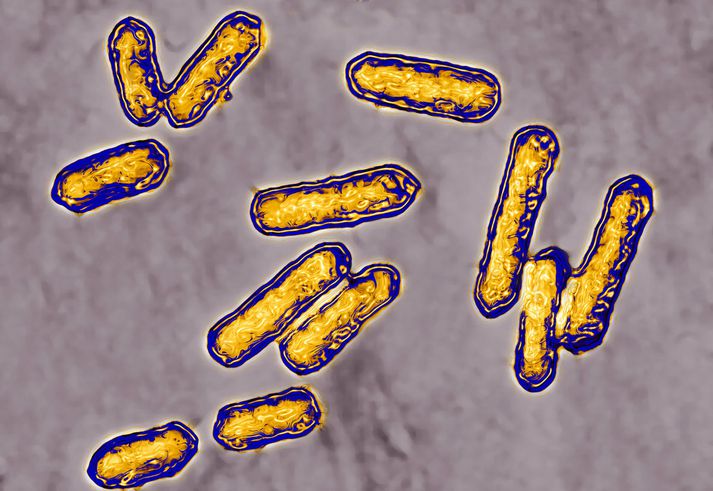 Listería, Listeria monocytogenes, er baktería sem berst helst í gegnum matvæli.