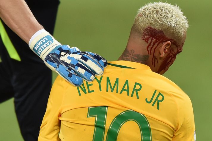 Neymar fékk skurð á hausinn í nótt og varð að yfirgefa völlinn. Það kom þó ekki að sök.