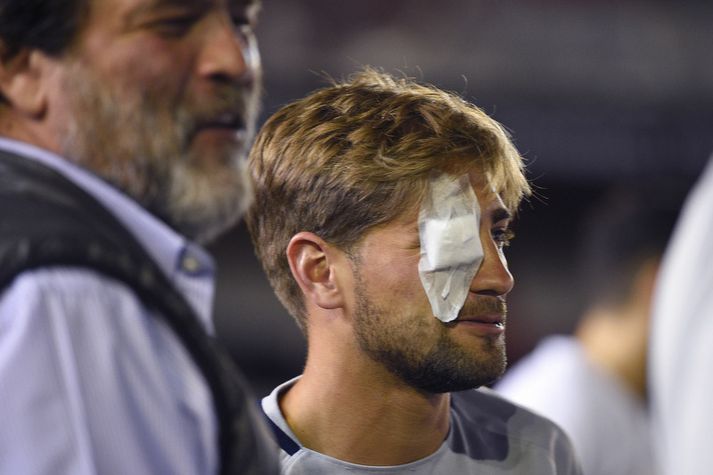 Gonzalo Lamardo, leikmaður Boca Juniors, slasaðist á auga í árásinni á liðsrútu Boca Juniors.