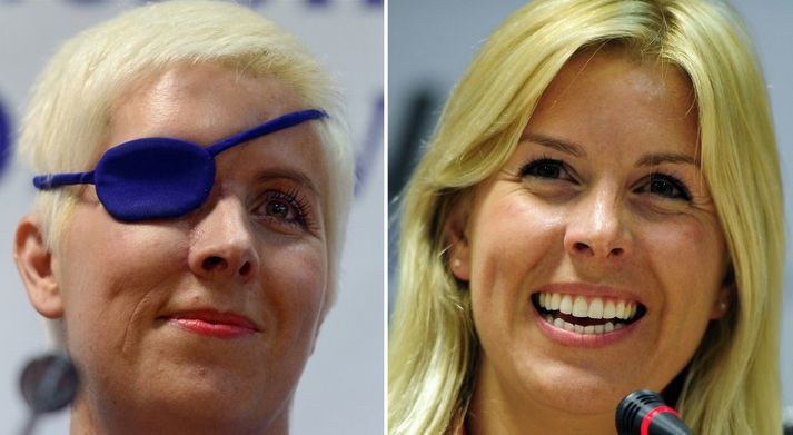 Eftir og fyrir. Maria de Villota er heppin að vera á lífi.